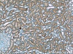 HACL1 Rabbit anti-Human, Mouse, Rat, Polyclonal, Proteintech:Antibodies:Primary