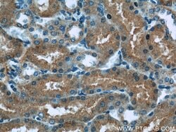 HACL1 Rabbit anti-Human, Mouse, Rat, Polyclonal, Proteintech:Antibodies:Primary