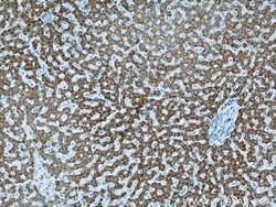 HACL1 Rabbit anti-Human, Mouse, Rat, Polyclonal, Proteintech:Antibodies:Primary