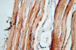 HACL1 Rabbit anti-Human, Mouse, Rat, Polyclonal, Proteintech:Antibodies:Primary