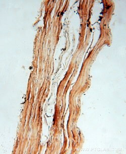 HACL1 Rabbit anti-Human, Mouse, Rat, Polyclonal, Proteintech:Antibodies:Primary