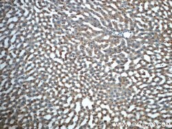 HACL1 Rabbit anti-Human, Mouse, Rat, Polyclonal, Proteintech:Antibodies:Primary