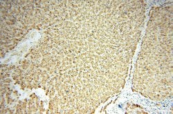 HACL1 Rabbit anti-Human, Mouse, Rat, Polyclonal, Proteintech:Antibodies:Primary