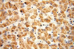 HACL1 Rabbit anti-Human, Mouse, Rat, Polyclonal, Proteintech:Antibodies:Primary