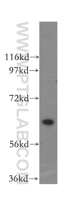 HACL1 Rabbit anti-Human, Mouse, Rat, Polyclonal, Proteintech