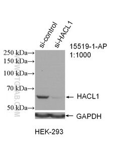 HACL1 Rabbit anti-Human, Mouse, Rat, Polyclonal, Proteintech:Antibodies:Primary
