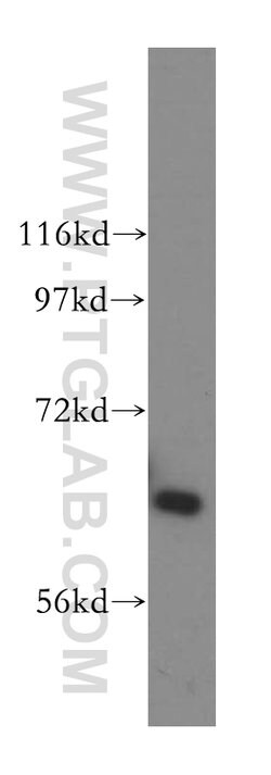HACL1 Rabbit anti-Human, Mouse, Rat, Polyclonal, Proteintech:Antibodies:Primary