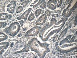 PAFAH Rabbit anti-Human, Mouse, Polyclonal, Proteintech:Antibodies:Primary
