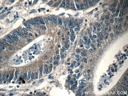 PAFAH Rabbit anti-Human, Mouse, Polyclonal, Proteintech:Antibodies:Primary