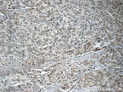 PAFAH Rabbit anti-Human, Mouse, Polyclonal, Proteintech:Antibodies:Primary