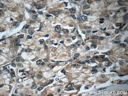 PAFAH Rabbit anti-Human, Mouse, Polyclonal, Proteintech:Antibodies:Primary