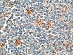 PAFAH Rabbit anti-Human, Mouse, Polyclonal, Proteintech:Antibodies:Primary