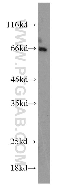 PAFAH Rabbit anti-Human, Mouse, Polyclonal, Proteintech:Antibodies:Primary