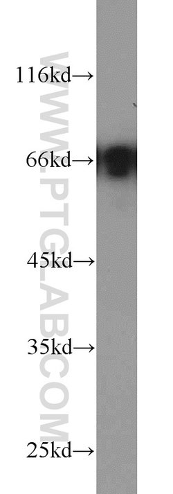 PAFAH Rabbit anti-Human, Mouse, Polyclonal, Proteintech:Antibodies:Primary