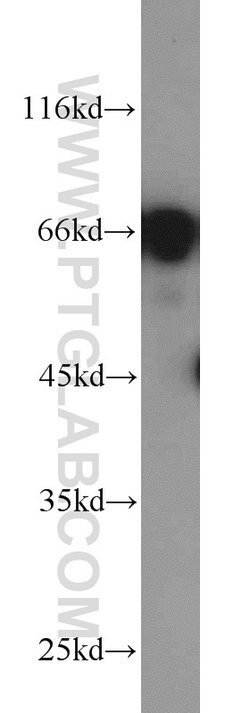 PAFAH Rabbit anti-Human, Mouse, Polyclonal, Proteintech:Antibodies:Primary
