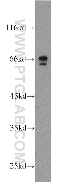 PAFAH Rabbit anti-Human, Mouse, Polyclonal, Proteintech:Antibodies:Primary