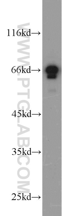 PAFAH Rabbit anti-Human, Mouse, Polyclonal, Proteintech:Antibodies:Primary