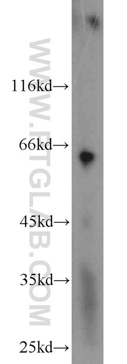 PAFAH Rabbit anti-Human, Mouse, Polyclonal, Proteintech:Antibodies:Primary
