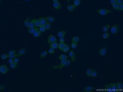 PAFAH Rabbit anti-Human, Mouse, Polyclonal, Proteintech:Antibodies:Primary