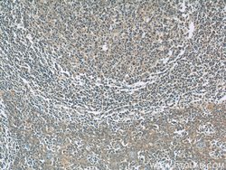 PAFAH Rabbit anti-Human, Mouse, Polyclonal, Proteintech:Antibodies:Primary