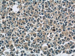 PAFAH Rabbit anti-Human, Mouse, Polyclonal, Proteintech:Antibodies:Primary