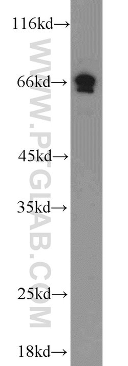 PAFAH Rabbit anti-Human, Mouse, Polyclonal, Proteintech:Antibodies:Primary