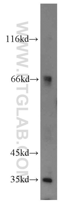 MTX1 Rabbit anti-Human, Mouse, Rat, Polyclonal, Proteintech:Antibodies:Primary