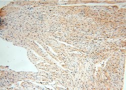 PPM1G Rabbit anti-Human, Mouse, Rat, Polyclonal, Proteintech 150 &mu;L;