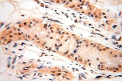 PPM1G Rabbit anti-Human, Mouse, Rat, Polyclonal, Proteintech 150 &mu;L;