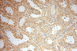 PPM1G Rabbit anti-Human, Mouse, Rat, Polyclonal, Proteintech 150 &mu;L;
