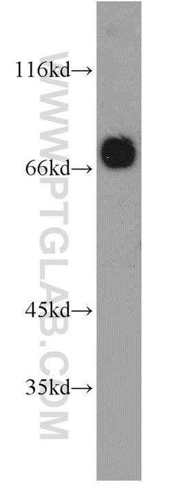 PPM1G Rabbit anti-Human, Mouse, Rat, Polyclonal, Proteintech 150 &mu;L;