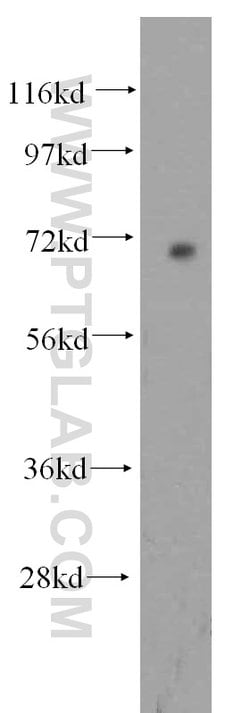 PPM1G Rabbit anti-Human, Mouse, Rat, Polyclonal, Proteintech 150 &mu;L;