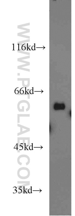 PDIR Rabbit anti-Human, Mouse, Rat, Polyclonal, Proteintech 150 &mu;L;