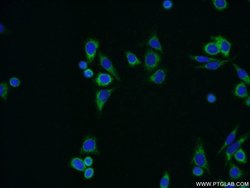 ALDH1B1 Rabbit anti-Human, Mouse, Rat, Polyclonal, Proteintech 150 &mu;L;