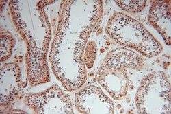 ALDH1B1 Rabbit anti-Human, Mouse, Rat, Polyclonal, Proteintech 150 &mu;L;