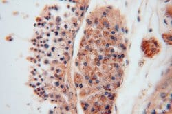 ALDH1B1 Rabbit anti-Human, Mouse, Rat, Polyclonal, Proteintech 150 &mu;L;