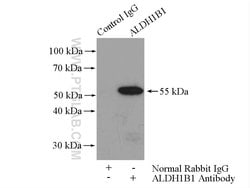 ALDH1B1 Rabbit anti-Human, Mouse, Rat, Polyclonal, Proteintech 150 &mu;L;