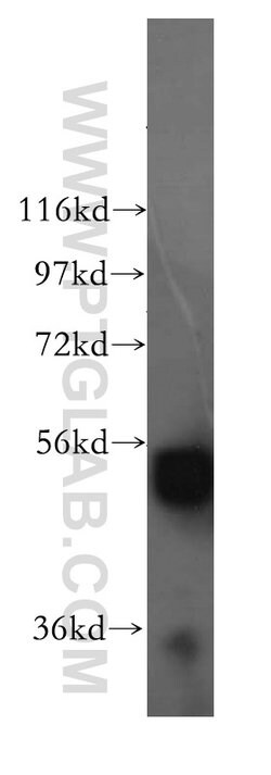 ALDH1B1 Rabbit anti-Human, Mouse, Rat, Polyclonal, Proteintech 150 &mu;L;