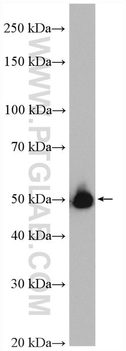 ALDH1B1 Rabbit anti-Human, Mouse, Rat, Polyclonal, Proteintech 150 &mu;L;