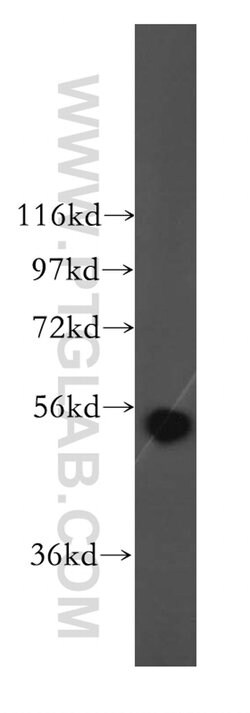 ALDH1B1 Rabbit anti-Human, Mouse, Rat, Polyclonal, Proteintech 150 &mu;L;