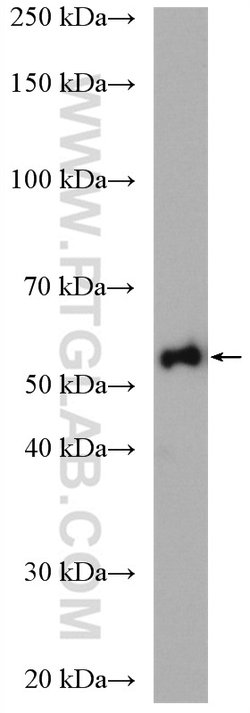ALDH1B1 Rabbit anti-Human, Mouse, Rat, Polyclonal, Proteintech 150 &mu;L;