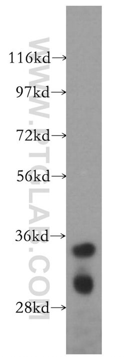 DIMT1L Rabbit anti-Human, Mouse, Rat, Polyclonal, Proteintech:Antibodies:Primary