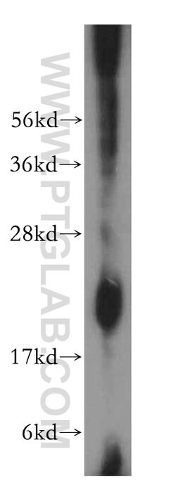NDUFB9 Rabbit anti-Human, Mouse, Rat, Polyclonal, Proteintech:Antibodies:Primary