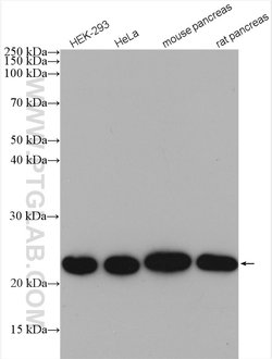 NDUFB9 Rabbit anti-Human, Mouse, Rat, Polyclonal, Proteintech:Antibodies:Primary