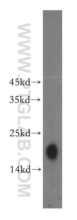 NDUFB9 Rabbit anti-Human, Mouse, Rat, Polyclonal, Proteintech:Antibodies:Primary