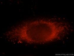 ALDH3A1 Rabbit anti-Human, Mouse, Rat, Polyclonal, Proteintech 150 &mu;L;