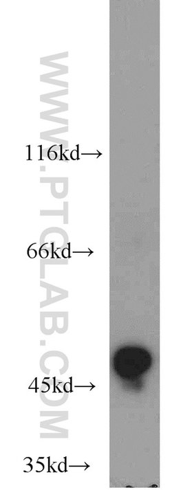 ALDH3A1 Rabbit anti-Human, Mouse, Rat, Polyclonal, Proteintech 150 &mu;L;