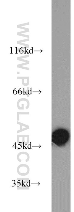ALDH3A1 Rabbit anti-Human, Mouse, Rat, Polyclonal, Proteintech 150 &mu;L;