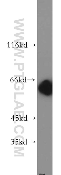 CBX2 Rabbit anti-Human, Mouse, Rat, Polyclonal, Proteintech 150 &mu;L;