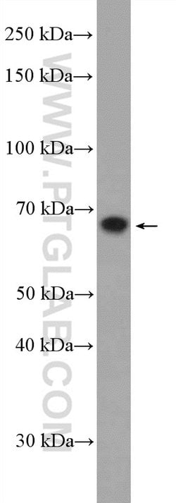 CBX2 Rabbit anti-Human, Mouse, Rat, Polyclonal, Proteintech 150 &mu;L;